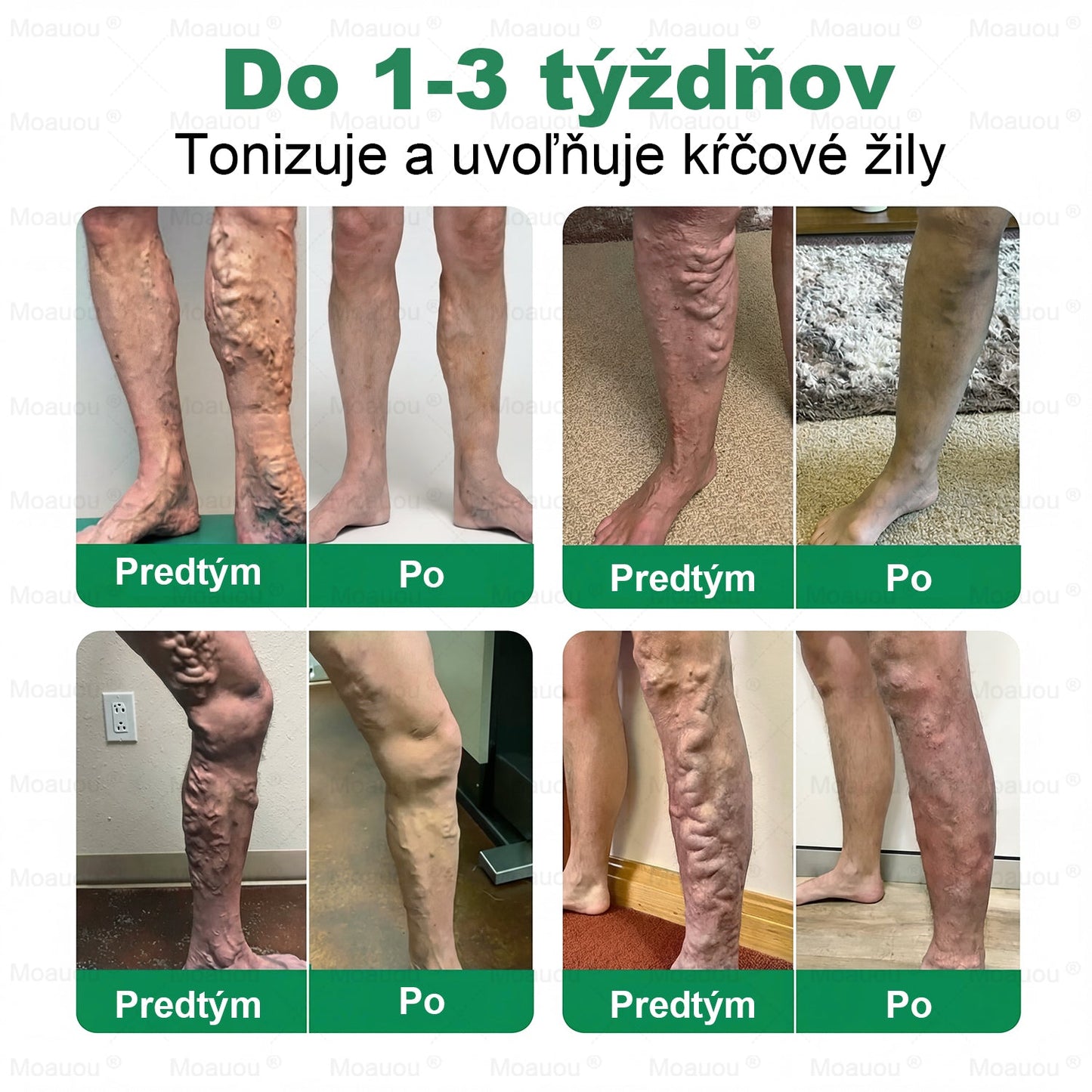 ⏰ Gratulujeme! Otvorili ste exkluzívnu ponuku pre Moauou®! Za vašu objednávku dnes získate dodatočnú 50 % zľavu! Kliknite na odkaz nižšie a využite túto špeciálnu ponuku — ponuka čoskoro vyprší! ⏰
