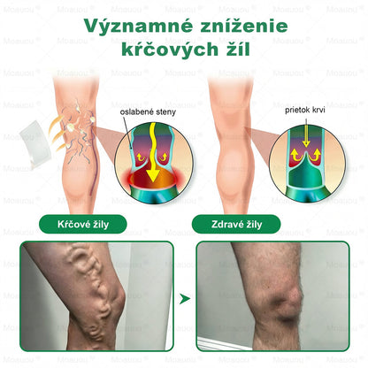 ⏰ Gratulujeme! Otvorili ste exkluzívnu ponuku pre Moauou®! Za vašu objednávku dnes získate dodatočnú 50 % zľavu! Kliknite na odkaz nižšie a využite túto špeciálnu ponuku — ponuka čoskoro vyprší! ⏰